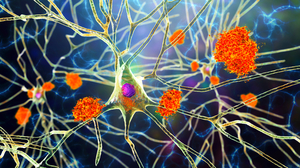 O nouă abordare în tratamentul unor boli neurodegenerative precum Parkinson şi Alzheimer
