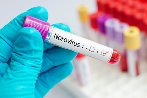 Un candidat de vaccin oral împotriva norovirusului, testat în studii clinice