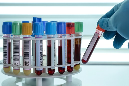 Cinci proteine din sânge, indicatori ai mortalităţii pe termen scurt şi lung