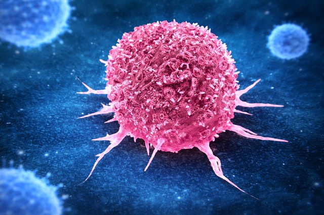 Poza pentru articolul Majoritatea cancerelor prevenibile sunt asociate cu două obiceiuri legate de stilul de viaţă