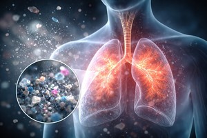 Microplasticele din aer pot afecta plămânii şi creşte riscul de boli respiratorii, avertizează un studiu