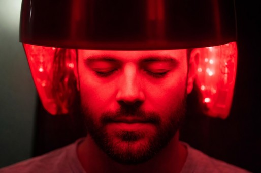 Terapie cu lumină, testată în laborator pentru combaterea căderii părului
