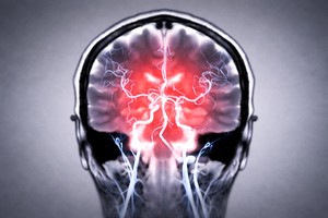 Bacteriile din intestin pot ajunge direct în creier, sugerează un studiu experimental