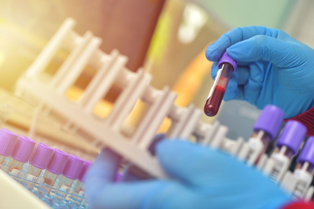 Ziua Mondială a Cancerelor de Sânge: Analizele de sânge periodice sunt esenţiale pentru un diagnostic timpuriu, când tratamentul poate fi mult mai eficient
