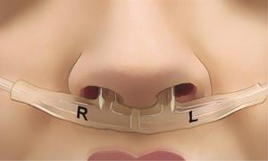 „Amprenta respiratorie”: o nouă frontieră în diagnostic şi sănătatea mintală