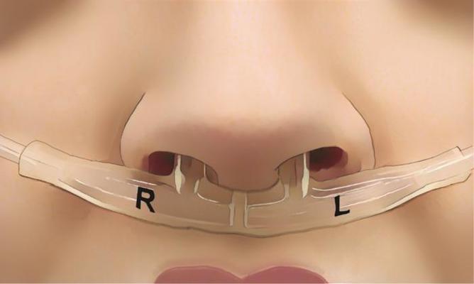„Amprenta respiratorie”: o nouă frontieră în diagnostic şi sănătatea mintală
