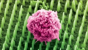 Sfârşitul biopsiilor tradiţionale? O nouă inovaţie promite un diagnostic fără durere pentru boli grave precum cancerul şi Alzheimer