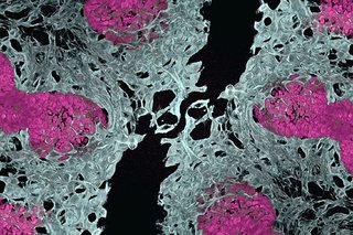 Oamenii de ştiinţă au creat primii organoizi pulmonari vascularizaţi deschizând noi perspective pentru bolile vasculare pulmonare
