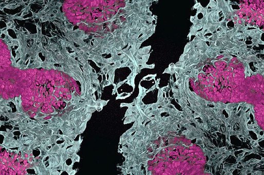 Oamenii de ştiinţă au creat primii organoizi pulmonari vascularizaţi 