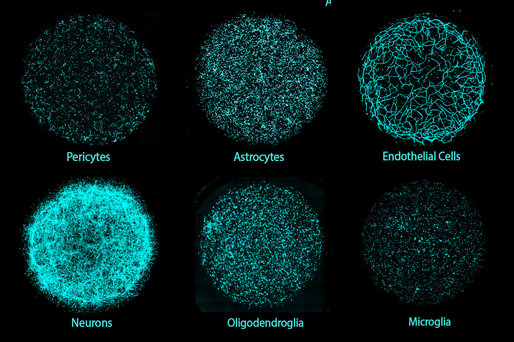Ţesuturi cerebrale create în laborator, care reproduc toate tipurile majore de celule, ar putea accelera cercetarea în terapiile neurologice 