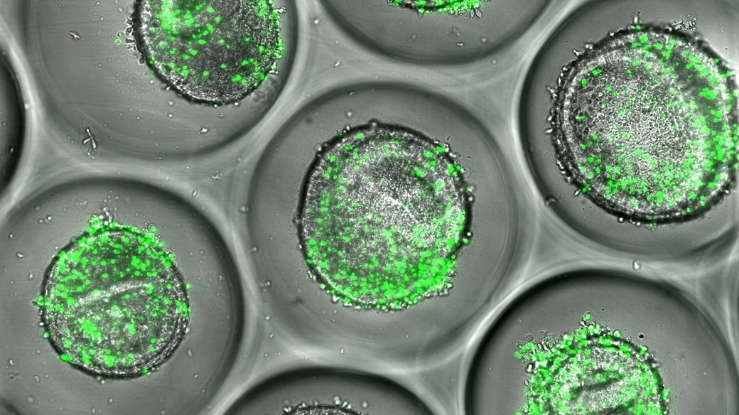 Progresele în dezvoltarea organoizilor deschid calea testelor personalizate pentru evaluarea siguranţei medicamentelor