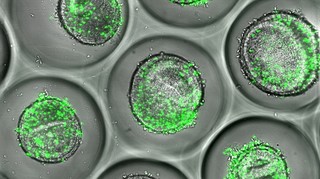 Progresele în dezvoltarea organoizilor deschid calea testelor personalizate pentru evaluarea siguranţei medicamentelor