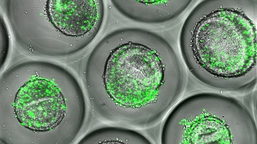 Progresele în dezvoltarea organoizilor deschid calea testelor personalizate pentru evaluarea siguranţei medicamentelor