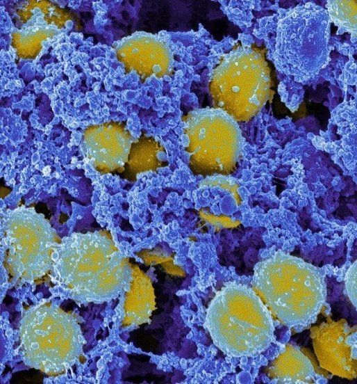 Virusurile ar putea deveni o nouă armă împotriva infecţiilor bacteriene rezistente la antibiotice