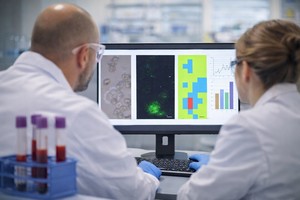 Un test de sânge revoluţionar pentru cancerul pulmonar, dezoltat de cercetători