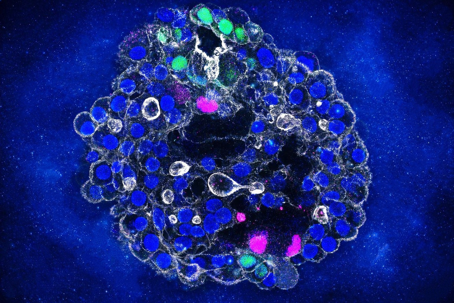 Ilustrație: Alertă sanitară explicată - Organoizi hepatici din celule umane, dezvoltaţi de cercetători pentru accelerarea dezvoltării tratamentelor personalizate la pacienţi (Medicina)