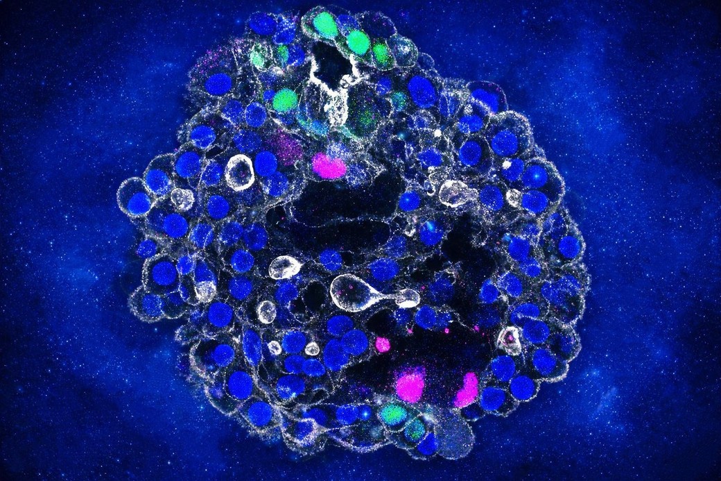 Organoizi hepatici din celule umane, dezvoltaţi de cercetători pentru accelerarea dezvoltării tratamentelor personalizate la pacienţi