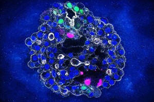 Organoizi hepatici din celule umane, dezvoltaţi de cercetători pentru accelerarea dezvoltării tratamentelor personalizate la pacienţi