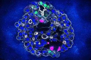 Organoizi hepatici din celule umane, dezvoltaţi de cercetători pentru accelerarea dezvoltării tratamentelor personalizate la pacienţi