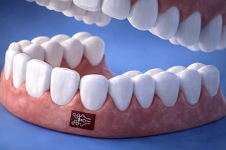 Un plasture inteligent poate ajuta la prevenirea bolii gingivale şi a pierderii dinţilor

