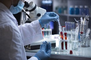 O nouă clasă de ţinte terapeutice pentru leucemiile agresive