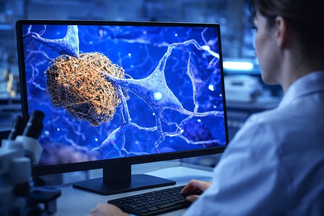 Poza pentru articolul Cercetătorii au observat în timp real reacţiile chimice implicate în agregarea proteinelor asociate bolii Alzheimer