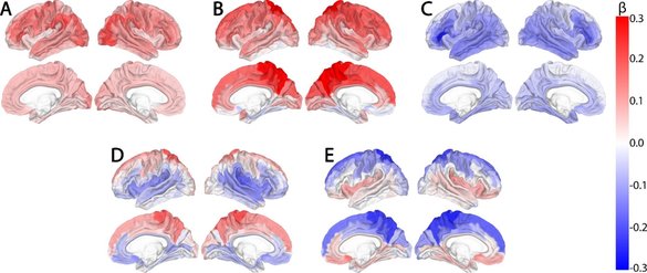 Pentru prima dată, cercetătorii au realizat o hartă a modului în care îmbătrâneşte fiecare zonă din creier