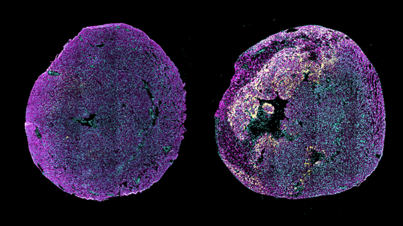 O nouă abordare ar putea ajuta inima să se repare singură după infarct