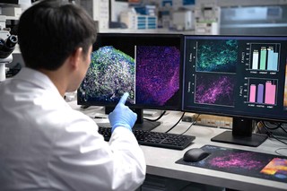 Cercetătorii au creat în laborator organoizi ai glandei pineale capabili să producă melatonină