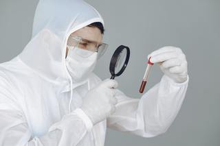 Legătura dintre virusul Epstein-Barr şi lupus, întărită de noi dovezi