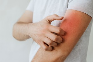 Medicii caută cea mai bună modalitate de a trata o boală genetică descoperită recent