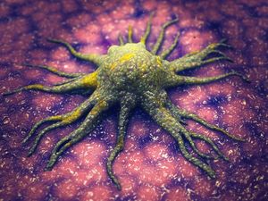 Abordare inovatoare pentru reducerea densităţii tumorilor cancerului şi creşterea eficienţei tratamentului