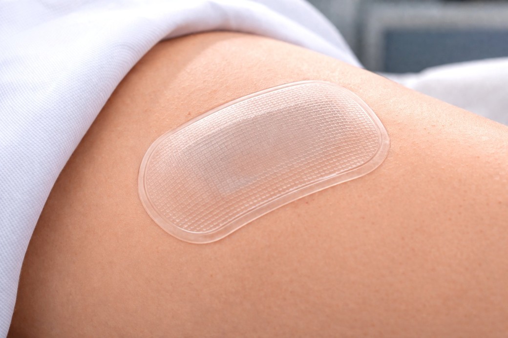 Un plasture activat termic poate distruge celulele de melanom fără intervenţie chirurgicală