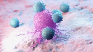 O imunoterapie inovatoare oferă speranţă pacienţilor cu cancer în stadii avansate