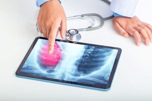 Un nou tratament pentru o formă rară de cancer pulmonar, aprobat în SUA