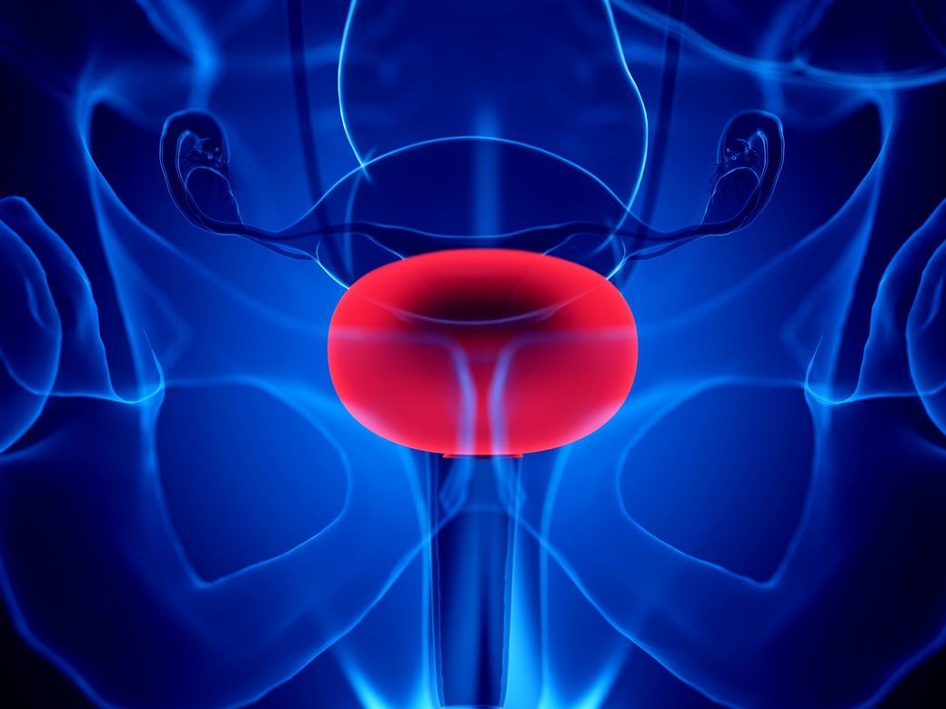 Un tratament non-chirurgical pentru cancerul vezicii urinare, autorizat în SUA