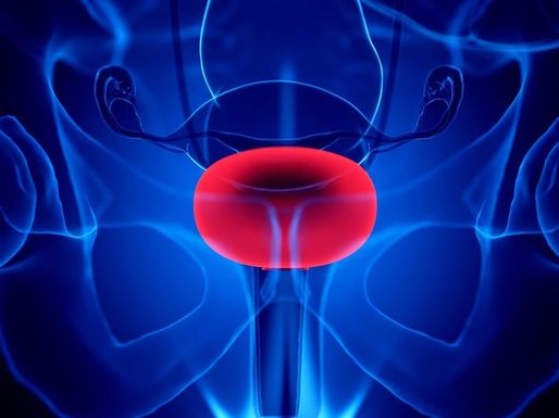 Un tratament non-chirurgical pentru cancerul vezicii urinare, autorizat în SUA