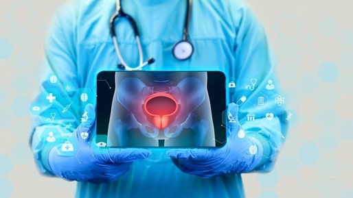 Terapie potenţială pentru un tip rar şi agresiv de cancer vezical