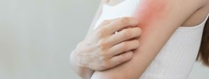 Ghidul american de dermatologie, actualizat cu noi recomandări terapeutice