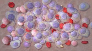 O terapie experimentală pentru o afecţiune precanceroasă a sângelui a generat un răspuns de 100%, potrivit rezultatelor prezentate la reuniunea anuală a Societăţii Internaţionale pentru Mielom