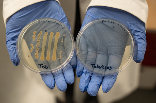 O nouă strategie de tratament pentru vindecarea rănilor cronice