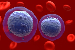 O terapie experimentală ar putea extinde opţiunile de tratament şi supravieţuirea pacienţilor cu leucemie