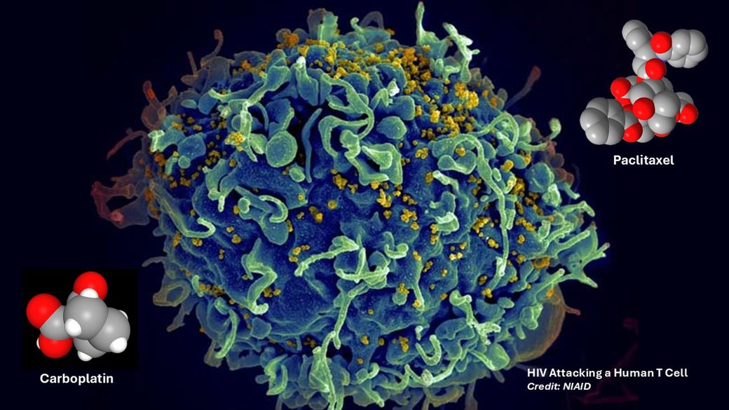 Un caz clinic sugerează o potenţială cale de eliminare a celulelor infectate cu HIV din organism