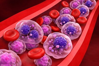 O nouă combinaţie de tratament pentru mielomul multiplu, autorizată în SUA