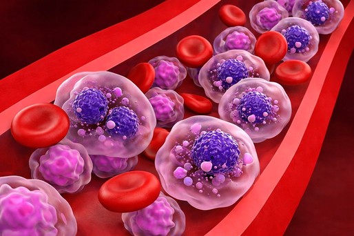 O nouă combinaţie de tratament pentru mielomul multiplu, autorizată în SUA