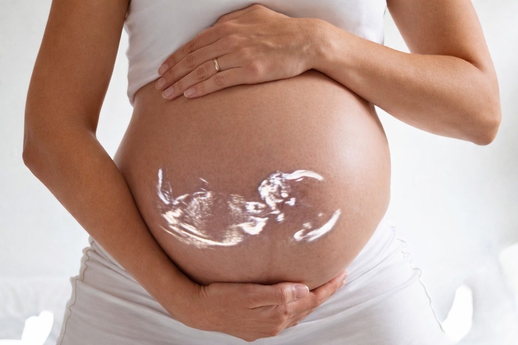 Terapia cu celule stem administrată intrauterin pentru spina bifida indică un profil de siguranţă favorabil în primele rezultate clinice