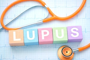 O terapie experimentală pentru lupusul eritematos sistemic primeşte desemnarea Fast Track din partea FDA din SUA