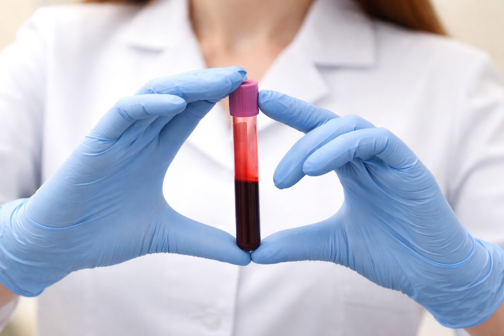 Creşterea nivelului de CO2 din atmosferă ar putea modifica chimia sângelui uman, sugerează un studiu
