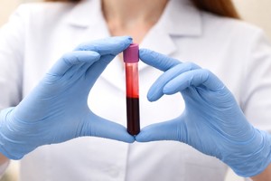 Creşterea nivelului de CO2 din atmosferă ar putea modifica chimia sângelui uman, sugerează un studiu
