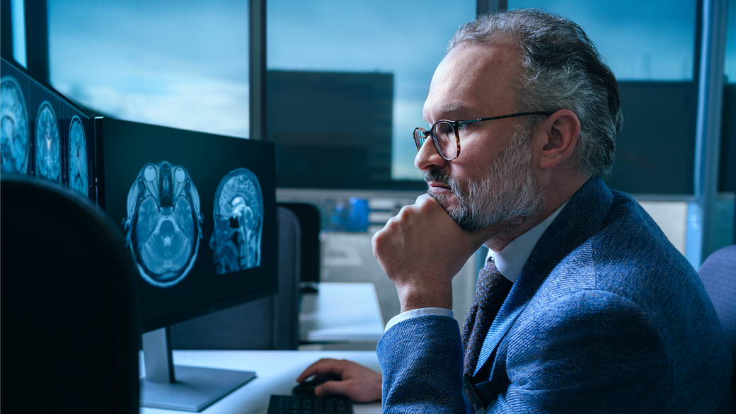 AI poate descifra mai multe boli neurodegenerative cu o singură scanare cerebrală